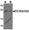 Tctex1 domain-containing protein 2 antibody, 6953, ProSci, Western Blot image 