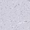 Charcot-Leyden Crystal Galectin antibody, NBP1-87688, Novus Biologicals, Immunohistochemistry paraffin image 