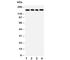 TN-R antibody, R30781, NSJ Bioreagents, Western Blot image 