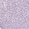 Solute Carrier Family 51 Beta Subunit antibody, NBP1-91108, Novus Biologicals, Immunohistochemistry paraffin image 