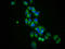 Solute Carrier Family 12 Member 3 antibody, LS-C681345, Lifespan Biosciences, Immunofluorescence image 