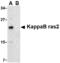 NFKB Inhibitor Interacting Ras Like 2 antibody, A13450, Boster Biological Technology, Western Blot image 