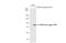 Hedgehog Interacting Protein antibody, GTX112565, GeneTex, Western Blot image 