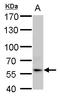 Interferon Alpha And Beta Receptor Subunit 1 antibody, GTX102902, GeneTex, Western Blot image 