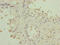 Peptidase, Mitochondrial Processing Beta Subunit antibody, LS-C676286, Lifespan Biosciences, Immunohistochemistry paraffin image 