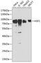 Heat Shock Transcription Factor 1 antibody, 15-191, ProSci, Western Blot image 