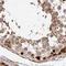 Proteasome 26S Subunit, Non-ATPase 7 antibody, NBP2-38612, Novus Biologicals, Immunohistochemistry paraffin image 