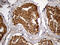 Glycogen Phosphorylase, Muscle Associated antibody, M02971, Boster Biological Technology, Immunohistochemistry paraffin image 