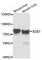 Endothelin Converting Enzyme 1 antibody, TA332806, Origene, Western Blot image 