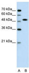 SRY-Box 11 antibody, TA335788, Origene, Western Blot image 