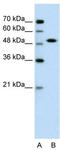 Transcription factor SOX-11 antibody, TA335788, Origene, Western Blot image 