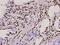 T-Box 18 antibody, A06044, Boster Biological Technology, Immunohistochemistry paraffin image 