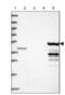 Cytochrome P450 Family 2 Subfamily D Member 6 antibody, NBP1-91818, Novus Biologicals, Western Blot image 