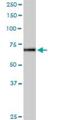 Interleukin 12 Receptor Subunit Beta 2 antibody, H00003595-D01P, Novus Biologicals, Western Blot image 