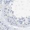 Serpin Family B Member 1 antibody, NBP1-89072, Novus Biologicals, Immunohistochemistry paraffin image 