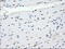 Crystallin Alpha B antibody, LS-C784392, Lifespan Biosciences, Immunohistochemistry paraffin image 