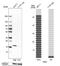 RecQ Mediated Genome Instability 2 antibody, NBP1-89962, Novus Biologicals, Western Blot image 