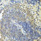 Receptor Interacting Serine/Threonine Kinase 1 antibody, LS-C331290, Lifespan Biosciences, Immunohistochemistry paraffin image 