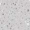 Cyclin Dependent Kinase 14 antibody, HPA015267, Atlas Antibodies, Immunohistochemistry frozen image 