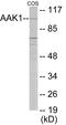 AP2 Associated Kinase 1 antibody, EKC1842, Boster Biological Technology, Western Blot image 