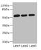 Acidic Residue Methyltransferase 1 antibody, CSB-PA867178LA01HU, Cusabio, Western Blot image 