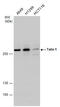 Talin 1 antibody, GTX102215, GeneTex, Western Blot image 