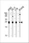 Glutathione S-Transferase Pi 1 antibody, A00394-2, Boster Biological Technology, Western Blot image 