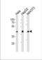 TATA-Box Binding Protein antibody, TA324501, Origene, Western Blot image 