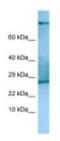 TSC22 Domain Family Member 2 antibody, NBP1-98342, Novus Biologicals, Western Blot image 