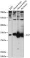 Carbonic Anhydrase 7 antibody, 15-498, ProSci, Western Blot image 