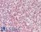 ETS Variant 6 antibody, LS-B13321, Lifespan Biosciences, Immunohistochemistry paraffin image 