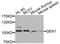 GEN1 Holliday Junction 5' Flap Endonuclease antibody, abx135921, Abbexa, Western Blot image 