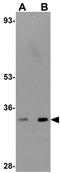 Transmembrane Protein 38B antibody, GTX85220, GeneTex, Western Blot image 