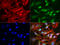 Gamma-Butyrobetaine Hydroxylase 1 antibody, LS-C799229, Lifespan Biosciences, Immunofluorescence image 