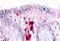 Macrophage Stimulating 1 Receptor antibody, NBP1-02377, Novus Biologicals, Immunohistochemistry paraffin image 