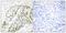 Activating Transcription Factor 2 antibody, PA5-38426, Invitrogen Antibodies, Immunohistochemistry paraffin image 