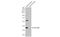 Solute Carrier Family 17 Member 3 antibody, GTX135781, GeneTex, Western Blot image 