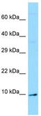 Olfactomedin 1 antibody, TA331217, Origene, Western Blot image 