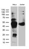 Chitinase Acidic antibody, LS-C795837, Lifespan Biosciences, Western Blot image 