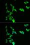 Adenylate Kinase 1 antibody, LS-C331362, Lifespan Biosciences, Immunofluorescence image 