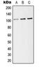 Thrombomodulin antibody, LS-B13229, Lifespan Biosciences, Western Blot image 