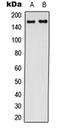 CF Transmembrane Conductance Regulator antibody, orb235093, Biorbyt, Western Blot image 