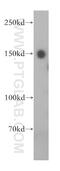 Tankyrase-1 antibody, 18030-1-AP, Proteintech Group, Western Blot image 