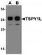 Testis Specific Protein Y-Linked 1 antibody, TA319728, Origene, Western Blot image 