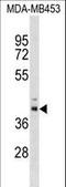 TRNA 5-Methylaminomethyl-2-Thiouridylate Methyltransferase antibody, LS-C157282, Lifespan Biosciences, Western Blot image 