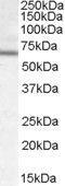 Dachshund Family Transcription Factor 2 antibody, GTX88789, GeneTex, Western Blot image 