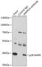 Mitogen-Activated Protein Kinase 13 antibody, 15-523, ProSci, Immunoprecipitation image 