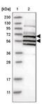 AT-Rich Interaction Domain 5A antibody, NBP1-81037, Novus Biologicals, Western Blot image 