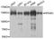 Serine/threonine-protein phosphatase 4 regulatory subunit 1 antibody, A8361, ABclonal Technology, Western Blot image 