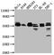MAPK Activated Protein Kinase 2 antibody, CSB-RA951792A0HU, Cusabio, Western Blot image 
